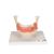 치아 질환 모형 Dental disease, magnified 2 times, 21 parts - 3B Smart Anatomy, 1000016 [D26], 치아 모형 (Small)