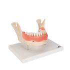 Afecci&oacute;n dental, a 2 aumentos, de 21 piezas, 1000016 [D26], Modelos dentales (Small)