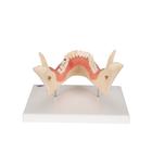 Afecci&oacute;n dental, a 2 aumentos, de 21 piezas, 1000016 [D26], Modelos dentales (Small)