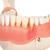 Afección dental, a 2 aumentos, de 21 piezas - 3B Smart Anatomy, 1000016 [D26], Modelos dentales (Small)