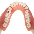 Dental Disease Model, Magnified 2 times, 21 parts, 1000016 [D26], Dental Models (Small)