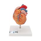 Sol Ventriküler Hipertrofi ile Klasik Kalp Modeli (LVH), 2 parçalı - 3B Smart Anatomy, 1000261 [G04], Kalp ve Dolaşım Modelleri