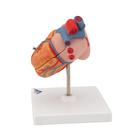C&oelig;ur classique avec hypertrophie du ventricule gauche (HVG), en 2 parties, 1000261 [G04], Mod&egrave;les c&oelig;ur et circulation (Small)