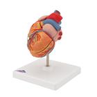 C&oelig;ur classique avec hypertrophie du ventricule gauche (HVG), en 2 parties, 1000261 [G04], Mod&egrave;les c&oelig;ur et circulation (Small)