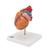 Corazón clásico con hipertrofia ventricular izquierda (HVI), de 2 piezas - 3B Smart Anatomy, 1000261 [G04], Modelos de Corazón (Small)