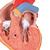 Coração clássico com hipertrofia ventricular esquerda, 2 partes, 1000261 [G04], Modelo de coração e circulação (Small)