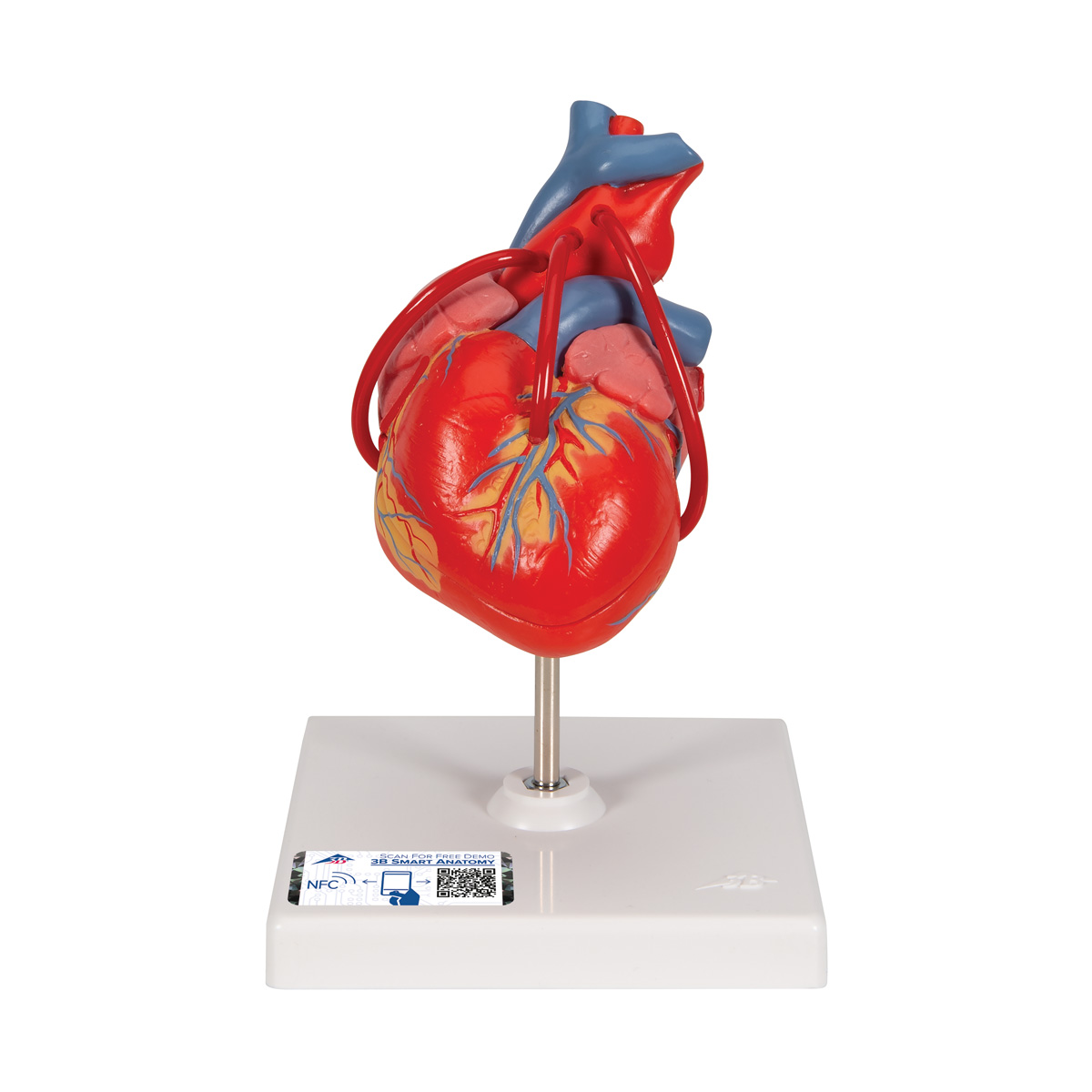 szív egészsége környezet művészet kardiovaszkuláris szövődmények magas vérnyomás esetén