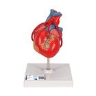 관상동맥 우회술 심장 모형 (2파트), 1017837 [G05], 심장 및 순환기 모형