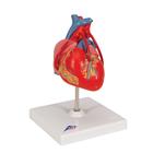 Classic Human Heart Model with Bypass, 2 part, 1017837 [G05], Human Heart Models (Small)