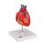Classic Human Heart Model with Bypass, 2 part - 3B Smart Anatomy, 1017837 [G05], Heart Health and Fitness Education (Small)