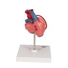 Classic Human Heart Model with Bypass, 2 part, 1017837 [G05], Human Heart Models (Small)