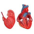 Cuore, modello classico, con bypass, in 2 parti, 1017837 [G05], Modelli di Cuore e Apparato Circolatorio (Small)