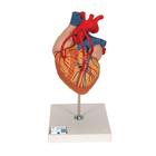 Herzmodell mit Bypass, 2-fache Größe, 4-teilig - 3B Smart Anatomy, 1000263 [G06], Herz- und Kreislaufmodelle