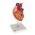 Human Heart Model with Bypass, 2 times Life-Size, 4 part - 3B Smart Anatomy, 1000263 [G06], Human Heart Models (Small)
