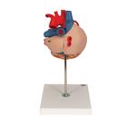 Human Heart Model with Bypass, 2 times Life-Size, 4 part, 1000263 [G06], Human Heart Models (Small)