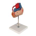Human Heart Model with Bypass, 2 times Life-Size, 4 part, 1000263 [G06], Human Heart Models (Small)