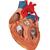 Coração com pontagem coronária, 2 vezes o tamanho natural, 4 partes, 1000263 [G06], Modelo de coração e circulação (Small)