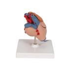C&oelig;ur classique avec thymus, en 3 parties, 1000265 [G08/1], Mod&egrave;les c&oelig;ur et circulation (Small)