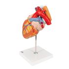 Cuore con trachea ed esofago, ingrandito 2 volte, in 5 parti, 1000269 [G13], Modelli di Cuore e Apparato Circolatorio (Small)