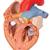 Szív nyelőcsővel és légcsővel, az eredeti méret 2-szerese, 5 részes - 3B Smart Anatomy, 1000269 [G13], Szív és érrendszeri modellek (Small)