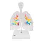 CT Bronchial Tree Model with Larynx & Transparent Lungs, 1000275 [G23/1], Lung Models (Small)