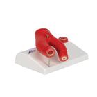 Modello di arteriosclerosi, con sezione delle arterie (in 2 parti), 1000278 [G40], Modelli di Cuore e Apparato Circolatorio (Small)