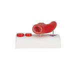 Arteriosclerosis Model, with Cross Section of Artery, 2 part, 1000278 [G40], Human Heart Models (Small)