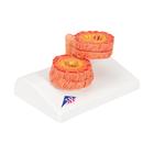 COPD Bronchial Tissue Model, 1012788 [G50/1], Lung Models (Small)