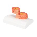 COPD Bronchial Tissue Model, 1012788 [G50/1], Lung Models (Small)