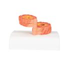 COPD Bronchial Tissue Model, 1012788 [G50/1], Lung Models (Small)