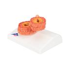 COPD Lungenmodell, 1012788 [G50/1], Lungenmodelle (Small)