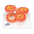COPD Bronchial Tissue Model, 1012788 [G50/1], Lung Models (Small)