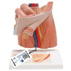 Lágyéksérv modell - 3B Smart Anatomy, 1000284 [H13], Nemi szerv és medence modellek