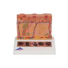 Hautkrebs Modell, 6 Stadien - 3B Smart Anatomy, 1000293 [J15], Hautmodelle