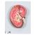 Kidney Section Model, 3 times Full-Size - 3B Smart Anatomy, 1000296 [K10], Urology Models (Small)