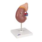 Kidney Model with Adrenal Gland, 2 part, 1014211 [K12], Urology Models (Small)