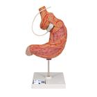 Модель желудка с бандажом - 3B Smart Anatomy, 1012787 [K15/1], Модели пищеварительной системы человека