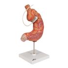Magenbandmodell, 1012787 [K15/1], Verdauungssystem (Small)