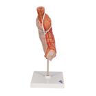 Magenbandmodell, 1012787 [K15/1], Verdauungssystem (Small)