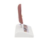 Kidney Stone Model, 1000316 [K29], Urology Models (Small)