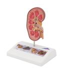 Modelo de c&aacute;lculo renal, 1000316 [K29], Modelos del Sistema Urinario (Small)