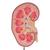 신장결석 모형
Kidney Stone Model - 3B Smart Anatomy, 1000316 [K29], 비뇨기계 모형 (Small)