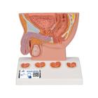 Prostat Modeli, 1/2 boyutunda - 3B Smart Anatomy, 1000319 [K41], Saglik egitimi - Erkekler