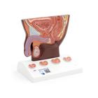Modello di prostata, &frac12; grandezza naturale,&nbsp;pelle scura, 1024384 [K41D], Modelli di Apparato Urinario (Small)