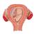 3개월의 태아 모형 Fetus Model, 3rd Month - 3B Smart Anatomy, 1000324 [L10/3], 인간 모형 (Small)