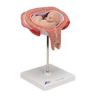 Fetus Model, 5th Month in Dorsal Position, 1000327 [L10/6], Pregnancy Models (Small)