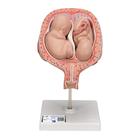 Модель 5-месячных плодов близнецов, нормальное положение - 3B Smart Anatomy, 1000328 [L10/7], Модели стадий беременности