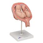 Twin Fetuses Model, 5th Month in Normal Position, 1000328 [L10/7], Pregnancy Models (Small)