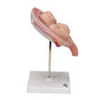 Twin Fetuses Model, 5th Month in Normal Position, 1000328 [L10/7], Pregnancy Models (Small)