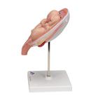 Twin Fetuses Model, 5th Month in Normal Position, 1000328 [L10/7], Pregnancy Models (Small)